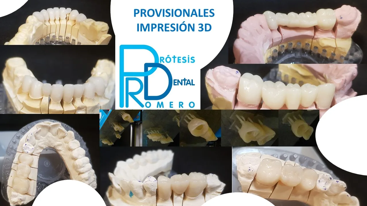 Provisionales 3D 2 | ANGEL LUIS ROMERO DE MIGUEL